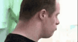 downs-down-syndrome.gif